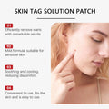 Hydrocolloid Removal Patches – Blackhead & Blemish Extractor